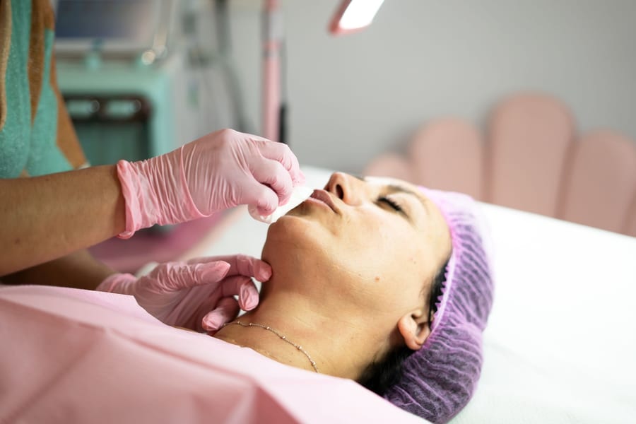 Lip Filler treatment